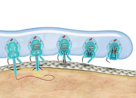 tentacle-stinging-diagram